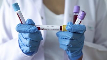 koronavirus maskedeposu coronavirus covid-19 korona virus corona tedbirler korunma salgin hastalik test asi dunya turkiye