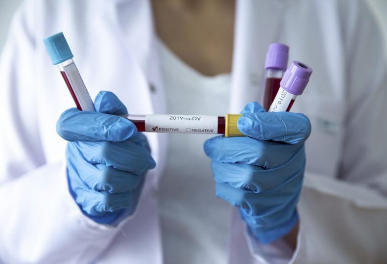 koronavirus maskedeposu coronavirus covid-19 korona virus corona tedbirler korunma salgin hastalik test asi dunya turkiye